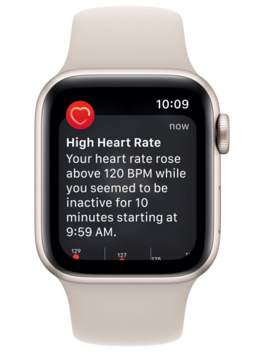 Apple watch se starlight aluminium. Apple watch Series se2 GPS 44mm Starlight Aluminium Case Sport Band. Смарт-часы Apple se GPS 40mm Starlight Aluminium (mnjp3) (2022). Apple watch se 44mm 2nd Gen. Смарт-часы Apple watch se 2022 44mm.